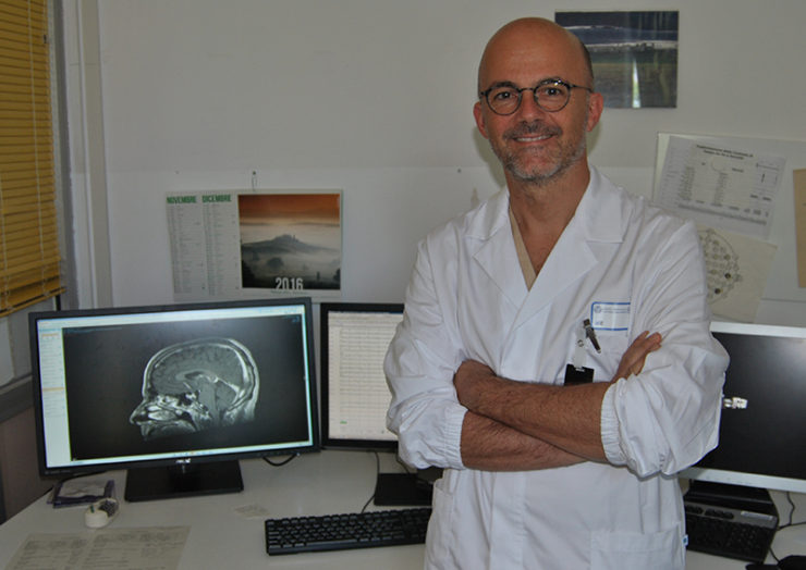 Neurologia: intervento elimina “tremore essenziale” in un 78enne