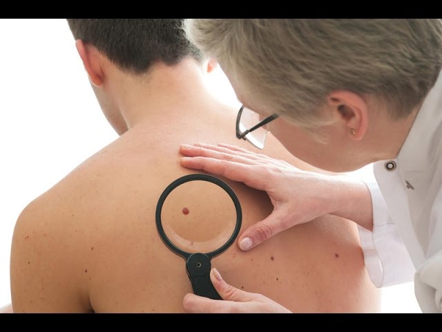 Melanoma: la Toscana istituisce la Rete clinica