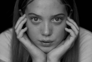 Eczema sul viso: come curare una patologia che colpisce adulti e bambini