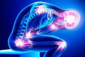 Fibromialgia: lo studio dell’Asl Toscana SE apre nuove prospettive terapeutiche