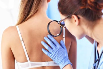 Tumori della pelle non melanoma: Toscana leader in diagnosi e cura