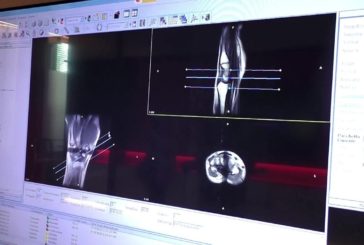 Così il 5G cambiera’ il modo di curarci