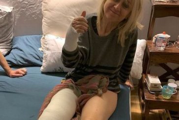 LITTIZZETTO CADE IN STRADA, BRACCIO E GAMBA INGESSATI