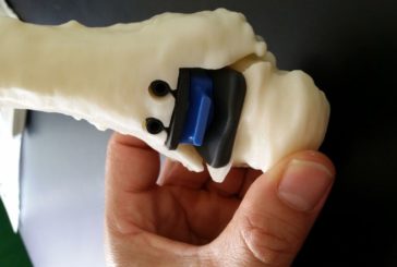 CAVIGLIA RICOSTRUITA IN 3D AL RIZZOLI DI BOLOGNA