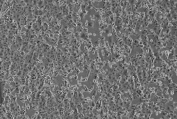 Coronavirus, positivo un italiano rimpatriato da Wuhan
