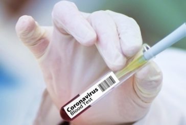 “I laboratori privati lucrano sulla paura della gente”