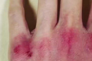 Infermieri per gli infermieri, arriva una raccolta di fondi