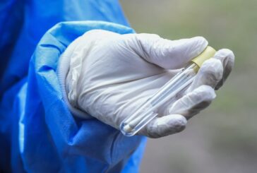 Coronavirus, da Granarolo 150.000 euro a Fondazione S.Orsola per ricerca
