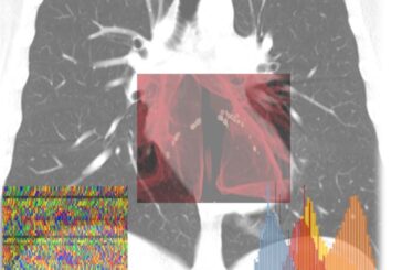 Ai-Score, l'intelligenza artificiale per calcolare il rischio Covid-19