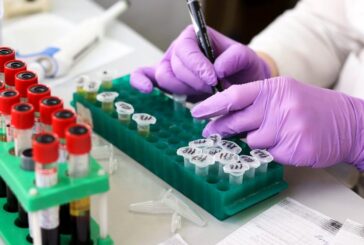 Magi (FdI): “Perché non usare i laboratori delle Scotte per le analisi?”