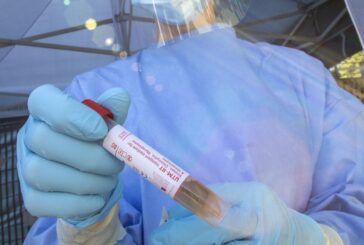 Coronavirus, Oms "L'Italia ha reagito con forza"