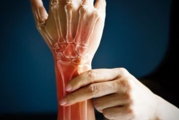 Artrite reumatoide, il farmaco Rinvoq adesso rimborsabile in Italia