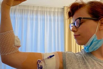 La figlia di Jovanotti vince il tumore "Voglio ricominciare a vivere"