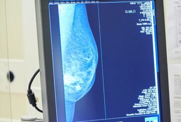 Tumore al seno, Europa Donna "Test genomici non ancora rimborsati"