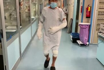 Gianni Morandi 10 giorni dopo l’incidente “Sono stato fortunato”