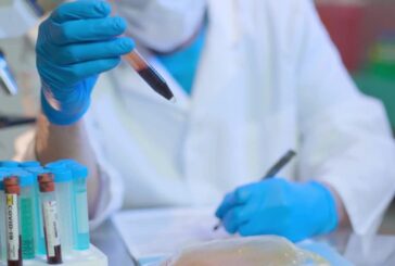 Nuova tecnica per identificare SARS-CoV-2 nei tamponi