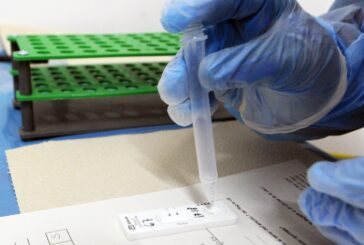 Covid, 75.862 nuovi casi e 325 decessi in 24 ore