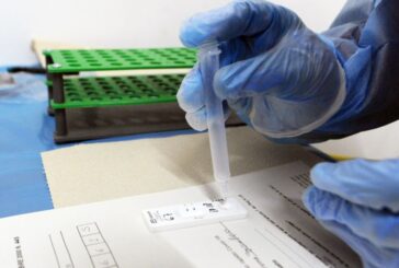 Ausl Tse: un percorso per le persone con difficoltà a effettuare il tampone