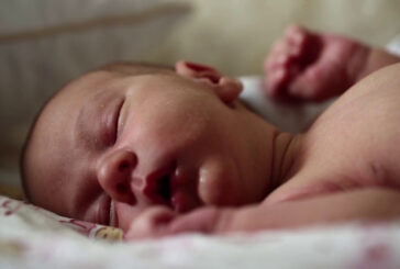 SMA, benefici nei bambini con terapia genica precoce