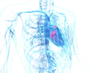 Ampliare rete delle emodinamiche per curare le valvulopatie cardiache
