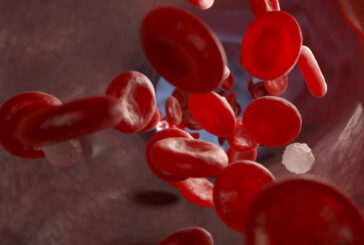 Beta-Talassemia, nuova molecola riduce la necessità di sangue
