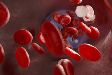 Beta-Talassemia, in Sicilia una rete per il trattamento