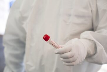 In Toscana 5.544 nuovi positivi, età media 47 anni. Otto i decessi
