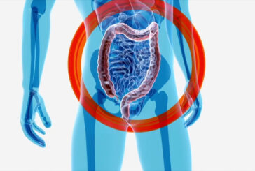 Intestino, l'importanza della varietà dei microrganismi