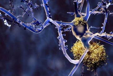 Alzheimer, Roche conferma il suo impegno in ricerca e sviluppo