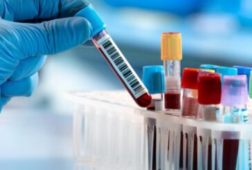 Distretto Senese: aumentano i prelievi per gli esami di laboratorio