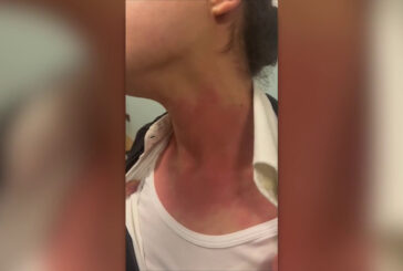 Norme più dure contro la violenza negli ospedali