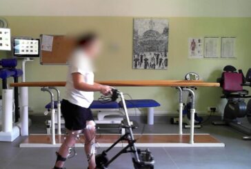 Un neurostimolatore midollare per camminare dopo una lesione spinale