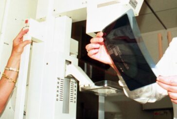Tumore al seno, i test genomici rafforzano i percorsi di cura