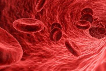 Leucemia linfoblastica acuta, in Italia la terapia Car-T di Gilead