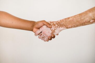 Malattie della pelle, Salutequità "Più programmazione e reti dedicate"