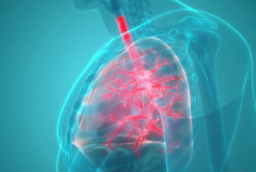 Nuove frontiere terapeutiche per la BPCO