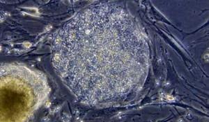 Medicina rigenerativa: Siena presenta le novità