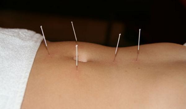 “Agopuntura: dalla tradizione alla medicina di domani”: incontro al SMS
